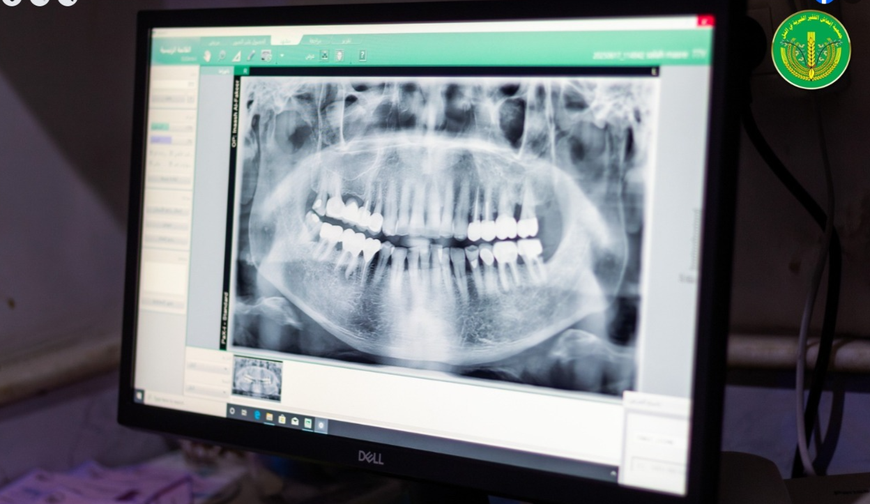 استبدال جهاز البانوراما القديم بجهاز بانوراما " Pax - i 2025 ". ✨💚